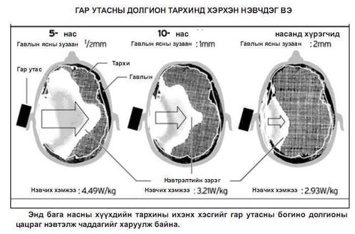 Хүүхдэдээ гар утас өгч тоглуулах нь асар хортой