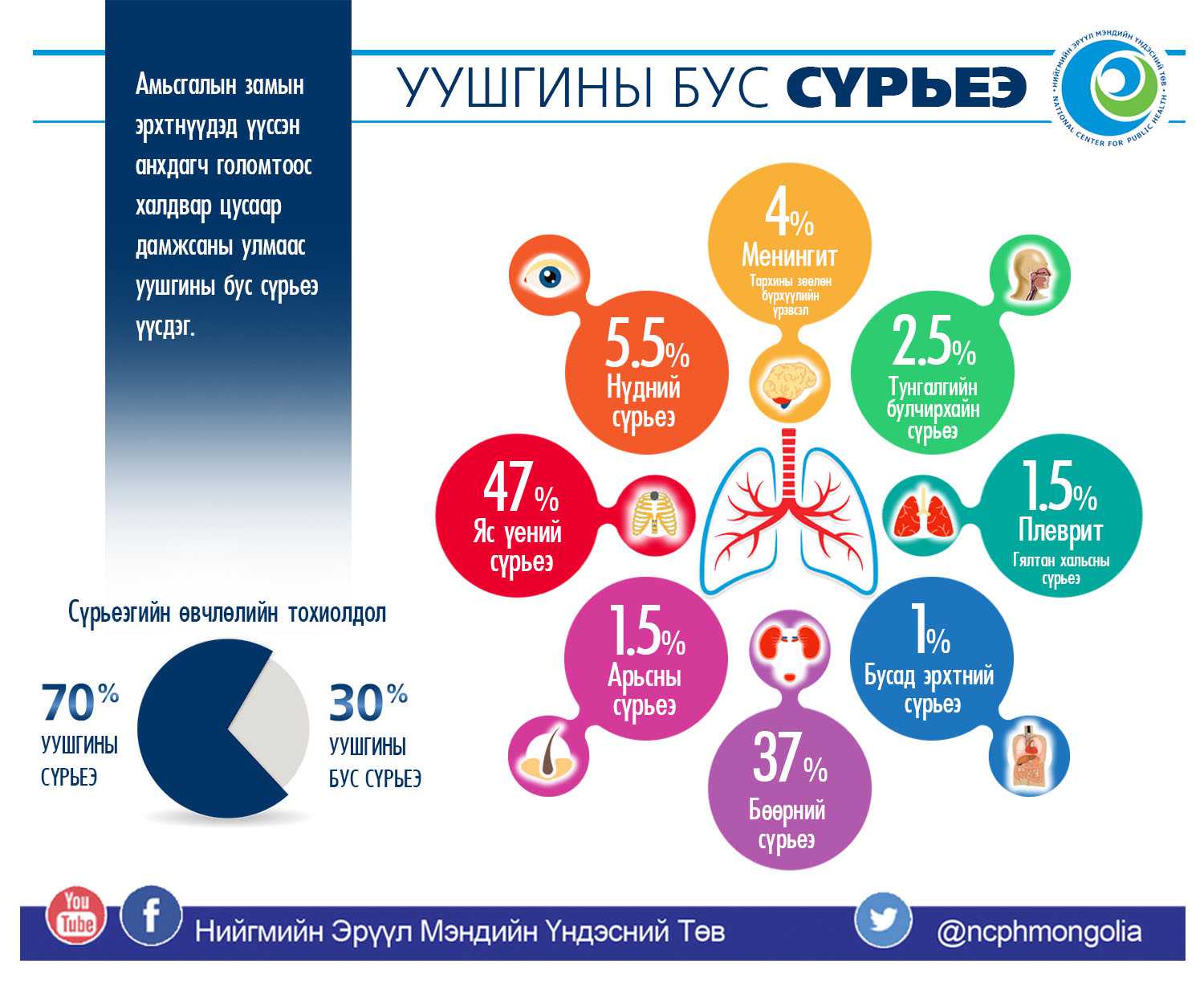 ИНФОГРАФИК:Уушигны бус сүрьеэ